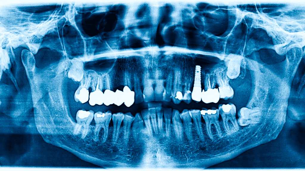 Blachy tytanowe SpecAllo